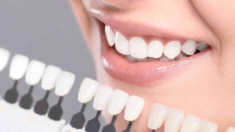 El fenómeno detrás de la obsesión por dientes blancos