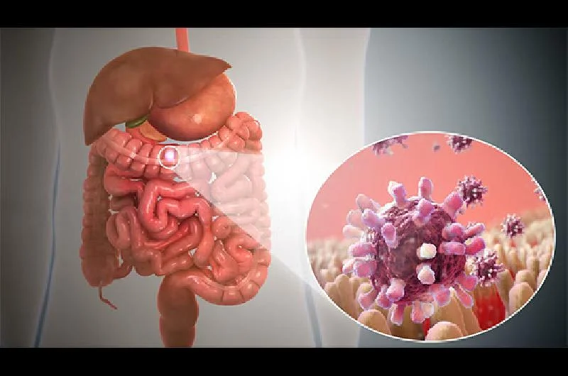 Gastritis vs Gastroenteritis: ¿Qué los diferencia realmente?