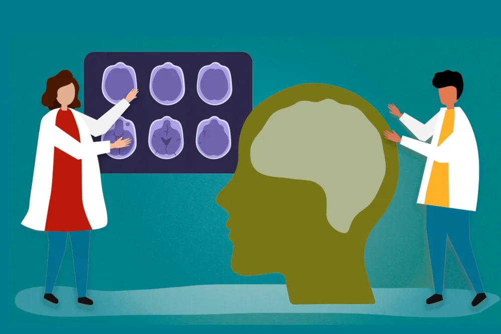 El Alzheimer en jóvenes: Prevención y cuidados tempranos