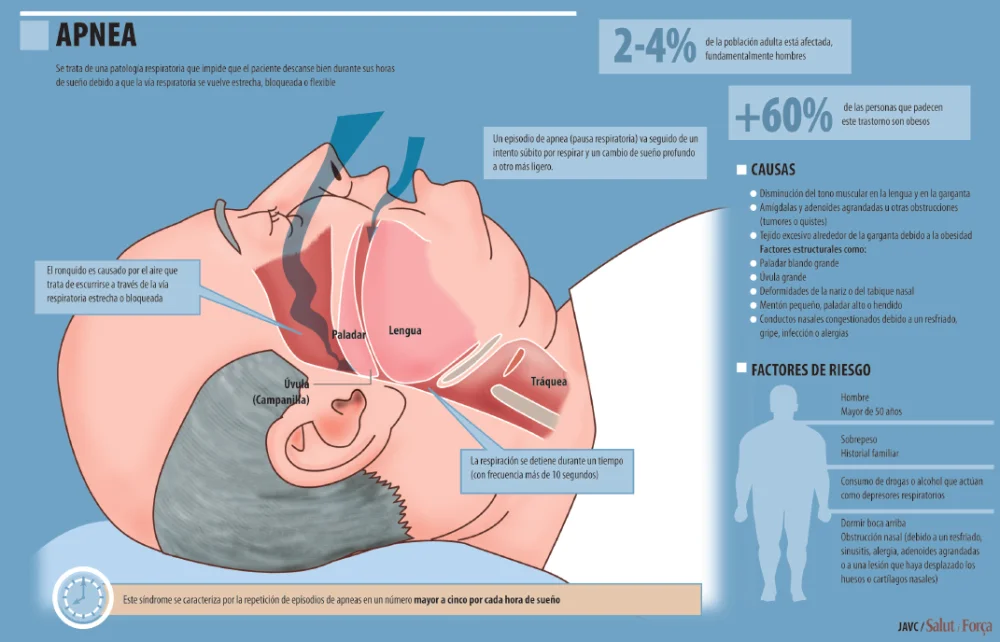 Problemas Respiratorios Nocturnos: Impacto y Soluciones