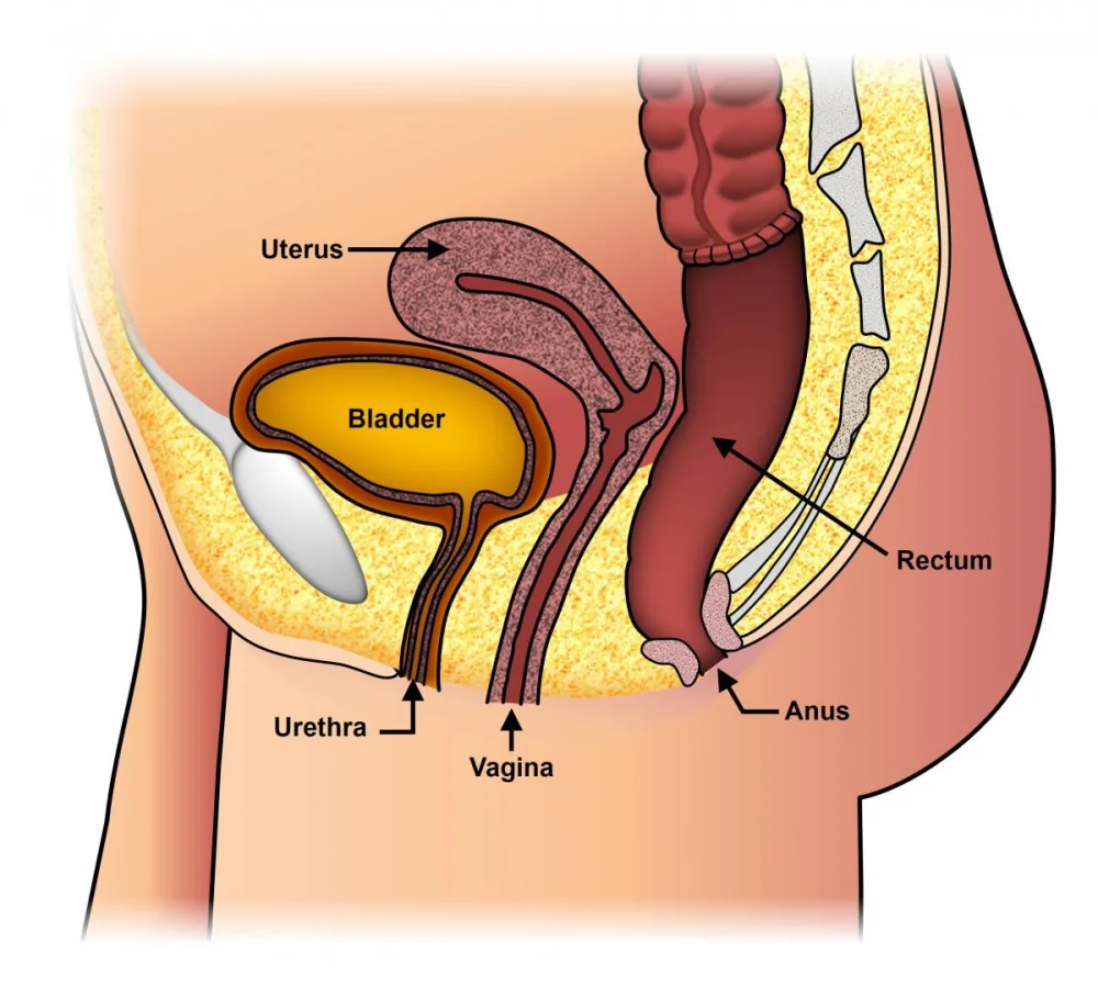 Guía Completa sobre el Prolapso Rectal