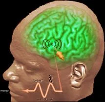 Misterios de la Corteza Motora del Cerebro Revelados
