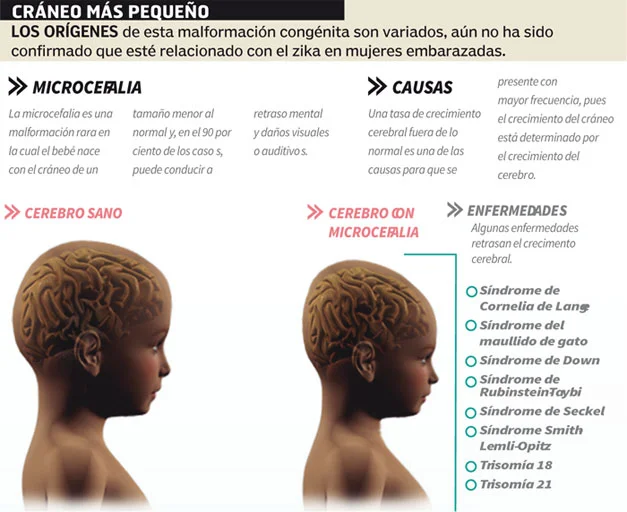 Implicancias y causas de la microcefalia