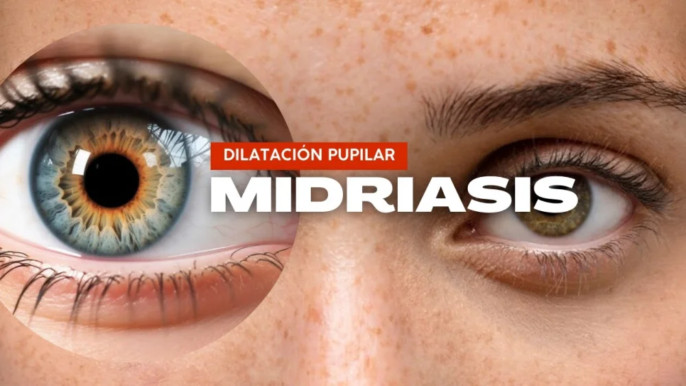 Secretos y causas detrás de la midriasis