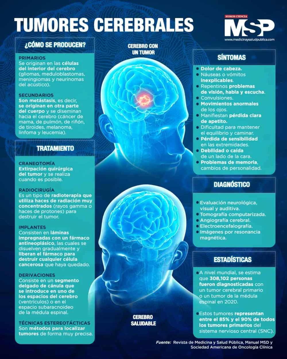Impacto del tumor cerebral en la salud humana