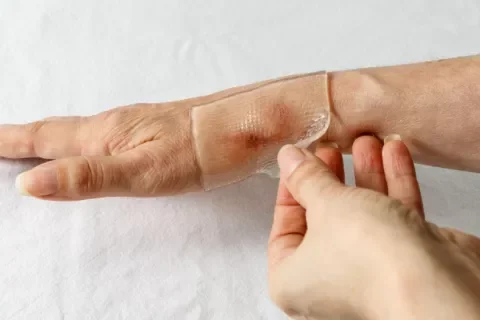 Adhesivos innovadores detectan emociones mediante la piel
