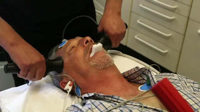 Innovaciones y beneficios de la terapia electroconvulsiva