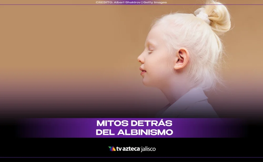 El mundo de las personas albinas: mitos y realidades