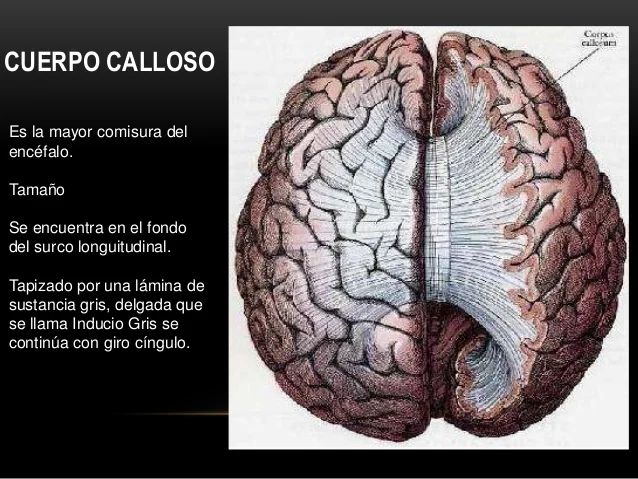 Conoce el Fascinante Mundo del Cuerpo Calloso Cerebral