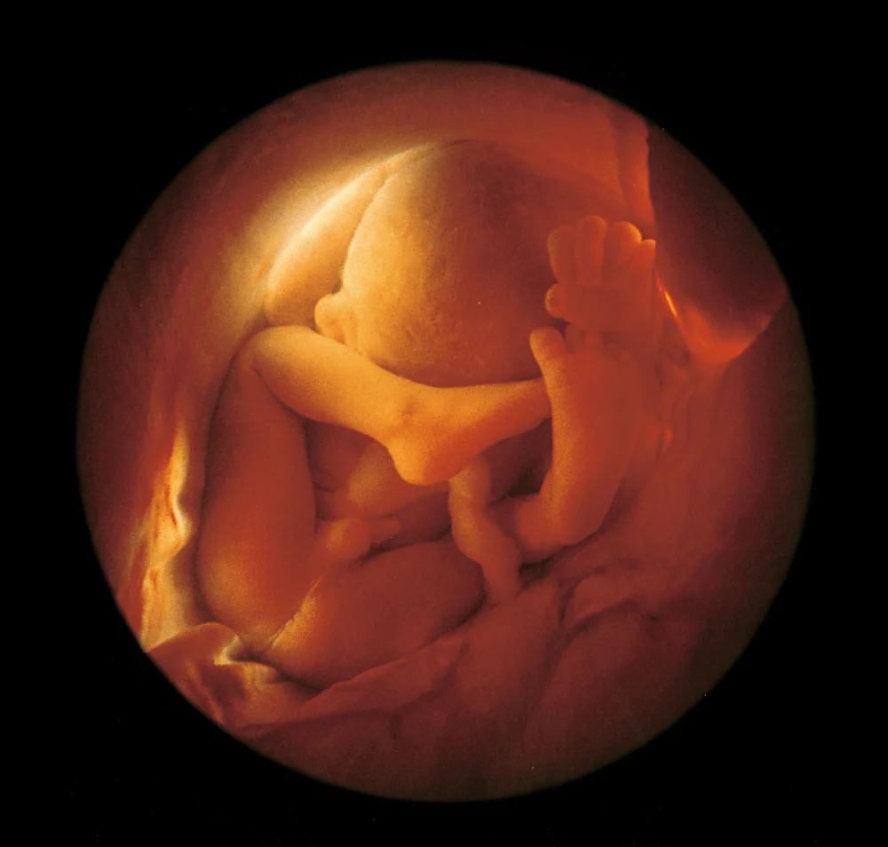 Todo sobre el misterioso vello fetal