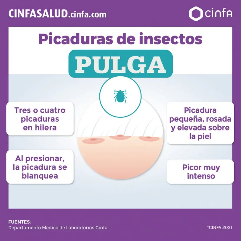 Todo sobre la picadura de pulga: síntomas y prevención
