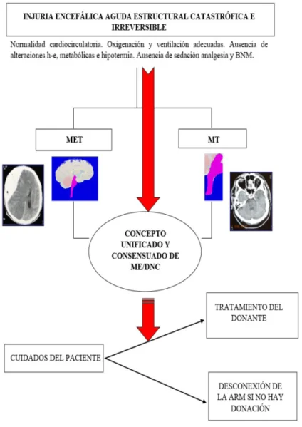 Comprende el fenómeno de la muerte cerebral