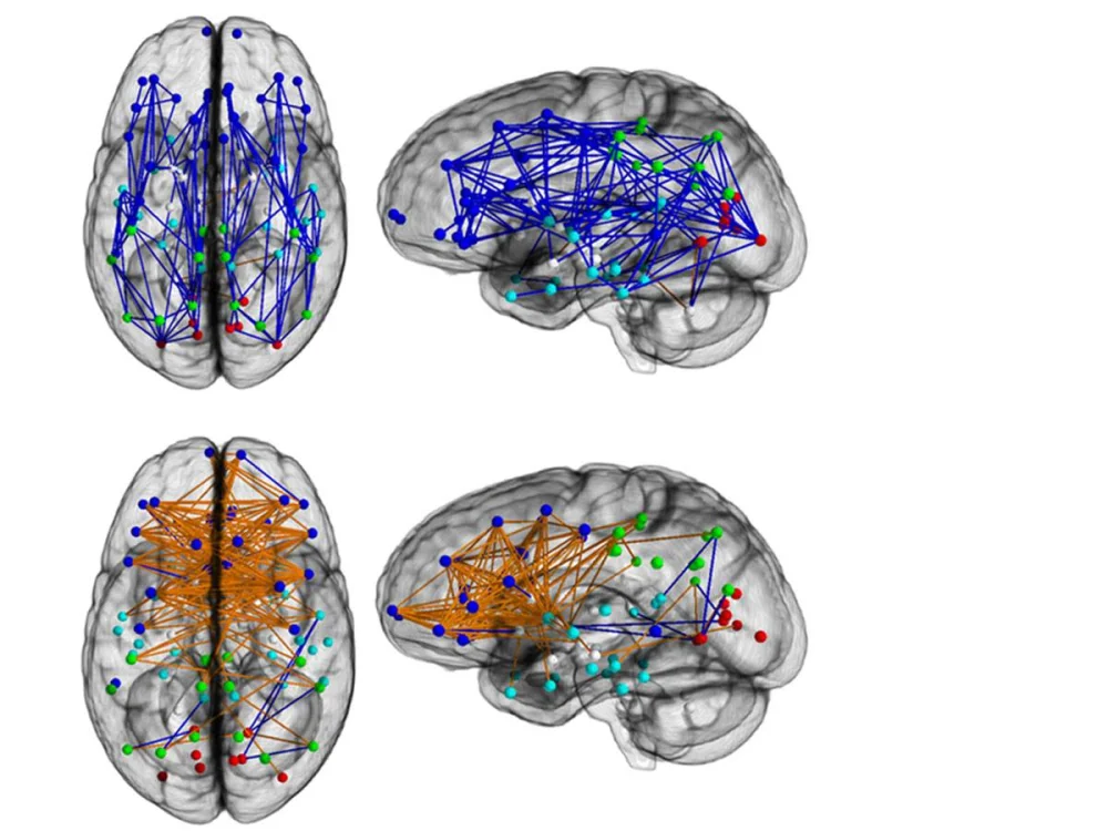 Conexiones entre los hemisferios cerebrales