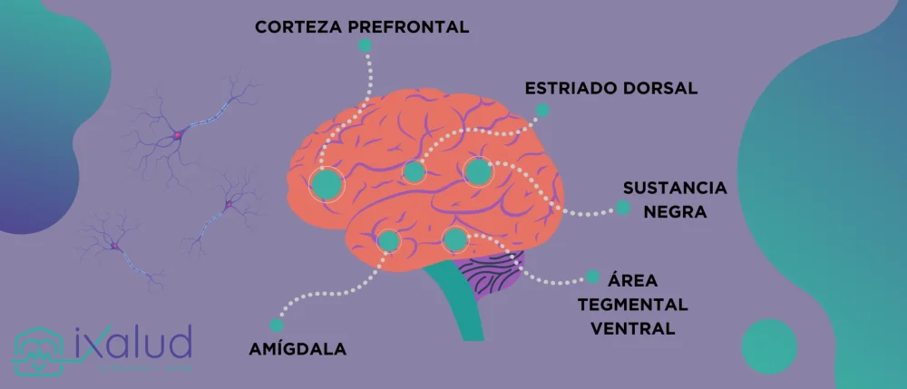 Impacto del Parkinson en la Salud Cerebral