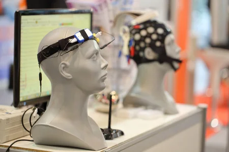 Aplicación del neurofeedback en el tratamiento del TDAH