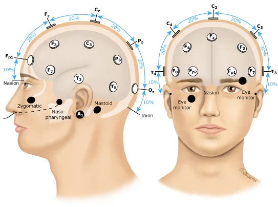 Interpretación y aplicaciones del electroencefalograma en la medicina moderna