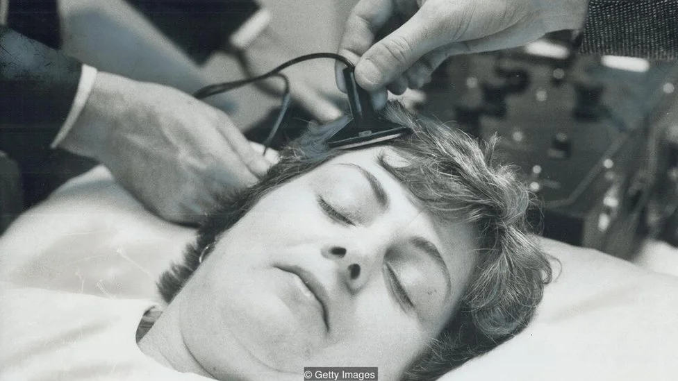 Impacto y Efectos del Electroshock en la Salud Mental