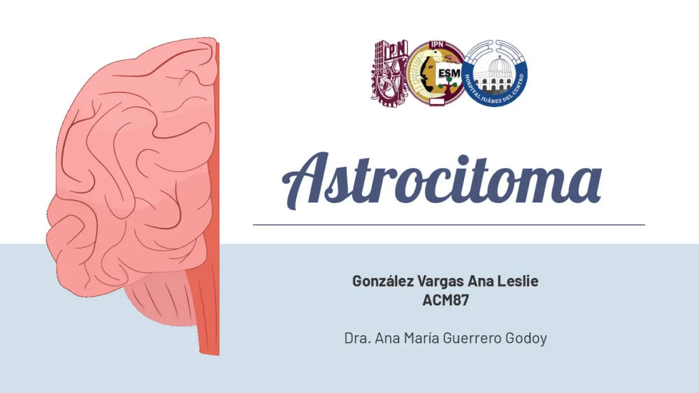 Profundizando en el Conocimiento del Astrocitoma
