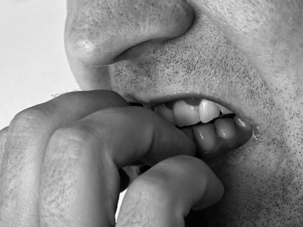 La dermatofagia: comprender este hábito poco conocido