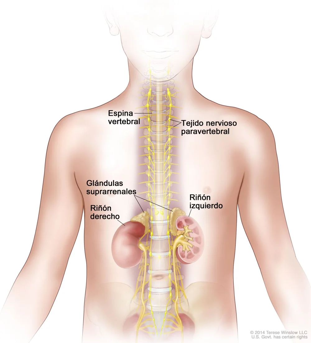Conoce lo esencial sobre el neuroblastoma en niños