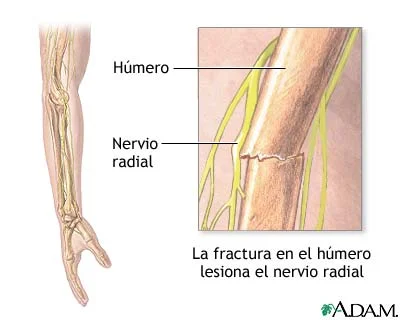 Conoce todo sobre el nervio radial