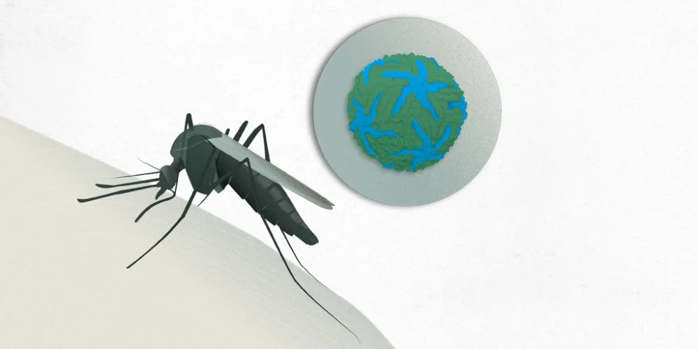 Enfermedad Japonesa: Encefalitis Virus y Prevención