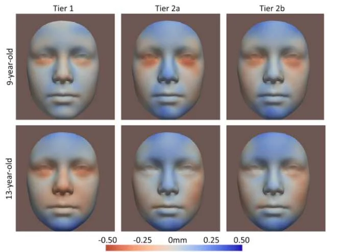 Indicios faciales del alcoholismo