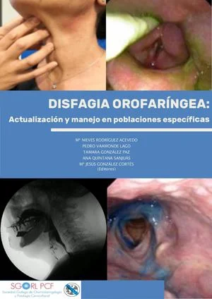Propiedades y aplicaciones de la loxapina: guía concisa