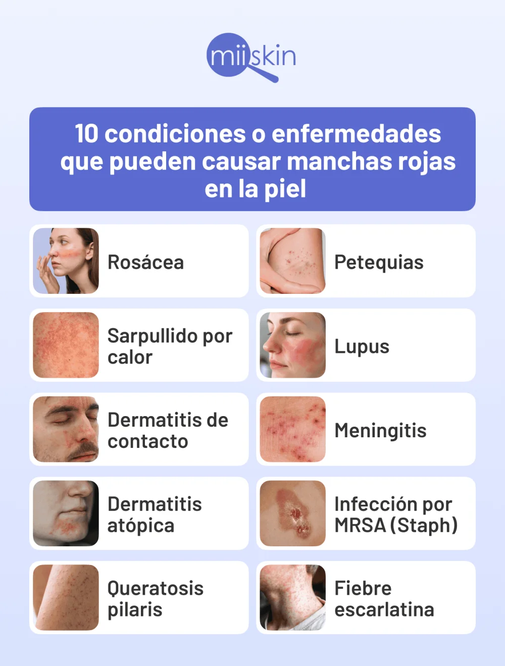 Causas y Soluciones para Manchas Rojas en la Piel