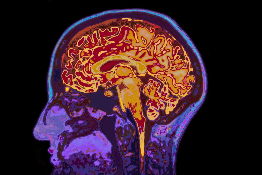 Hablar varios idiomas protege contra el Alzheimer