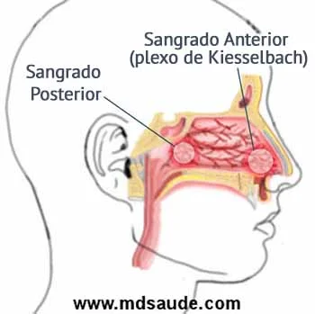 Miedo a las hemorragias nasales: causas y soluciones