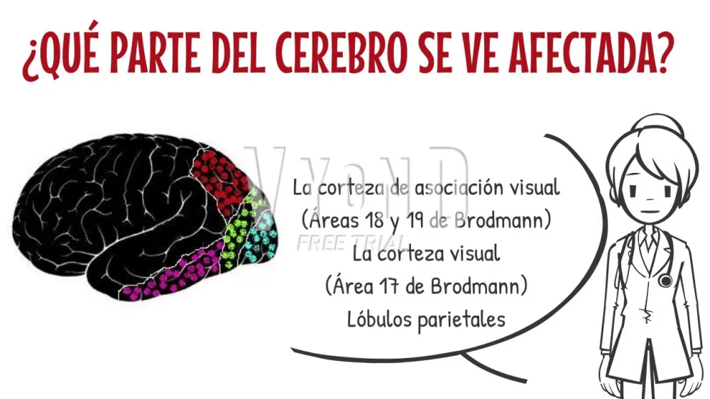 Misterios del Síndrome de Anton: Una Realidad Invertida
