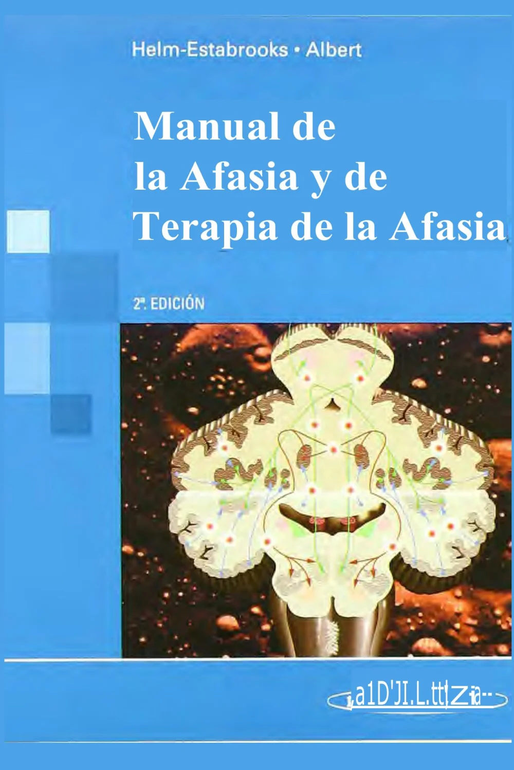 Variedades de la afasia: una guía informativa