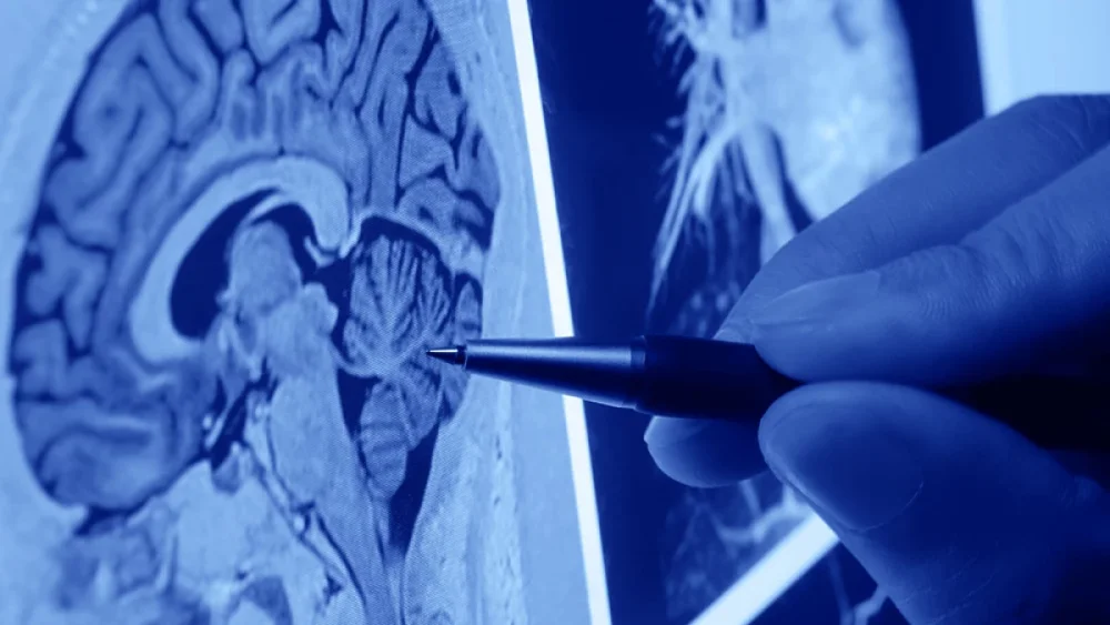 Variedades de Especialistas en Neurología