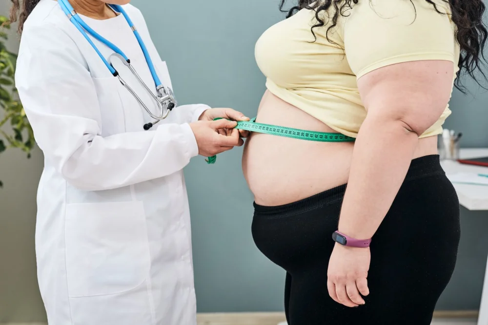 Clasificación de la obesidad: conoce sus diferentes tipos