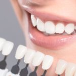El fenómeno detrás de la obsesión por dientes blancos