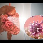 Gastritis vs Gastroenteritis: ¿Qué los diferencia realmente?