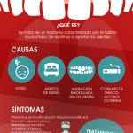 Todo sobre el bruxismo y el rechinar de dientes