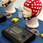 Beneficios de la Estimulación Transcraneal de Corriente Alterna
