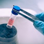 Células madre: tratamiento innovador para enfermedades neurológicas