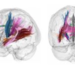Ciencia revela cambios cerebrales al convertirse en madre
