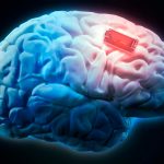 Crean dispositivo cerebral innovador para tratar la epilepsia