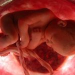 ¿Cuándo comienza un feto a experimentar dolor?