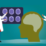 El Alzheimer en jóvenes: Prevención y cuidados tempranos