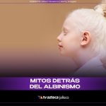 El mundo de las personas albinas: mitos y realidades