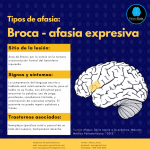 Entendiendo el trastorno del lenguaje: Afasia de Broca
