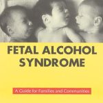 Identificación del síndrome alcohólico fetal: guía esencial