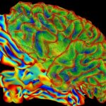 Impacto de la Psicoterapia en la Transformación Cerebral