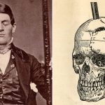 Impacto de una barra metálica en la vida de Phineas Gage