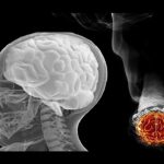 Impacto del tabaco en el cerebro humano